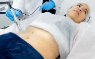 Tratamiento para estras
