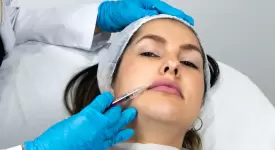 Rellenos faciales