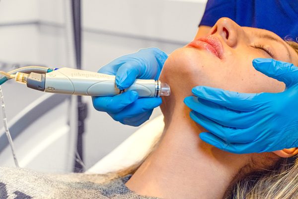 Limpieza facial profunda con Hydrafacial