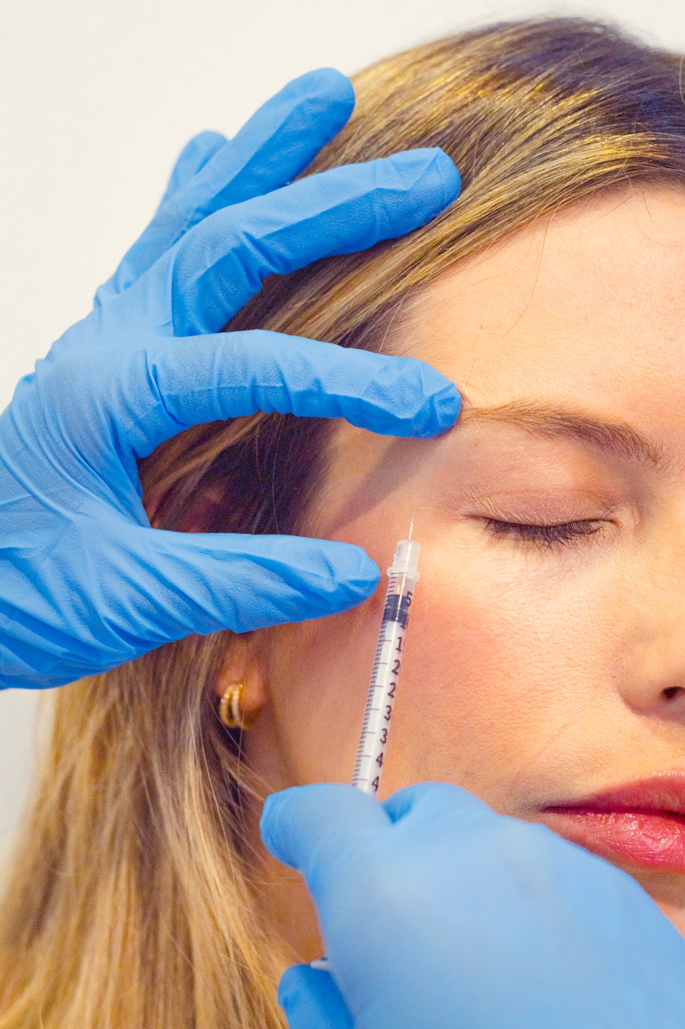Polinucleótidos de salmón en el contorno de ojos en Skin Plus Bogotá