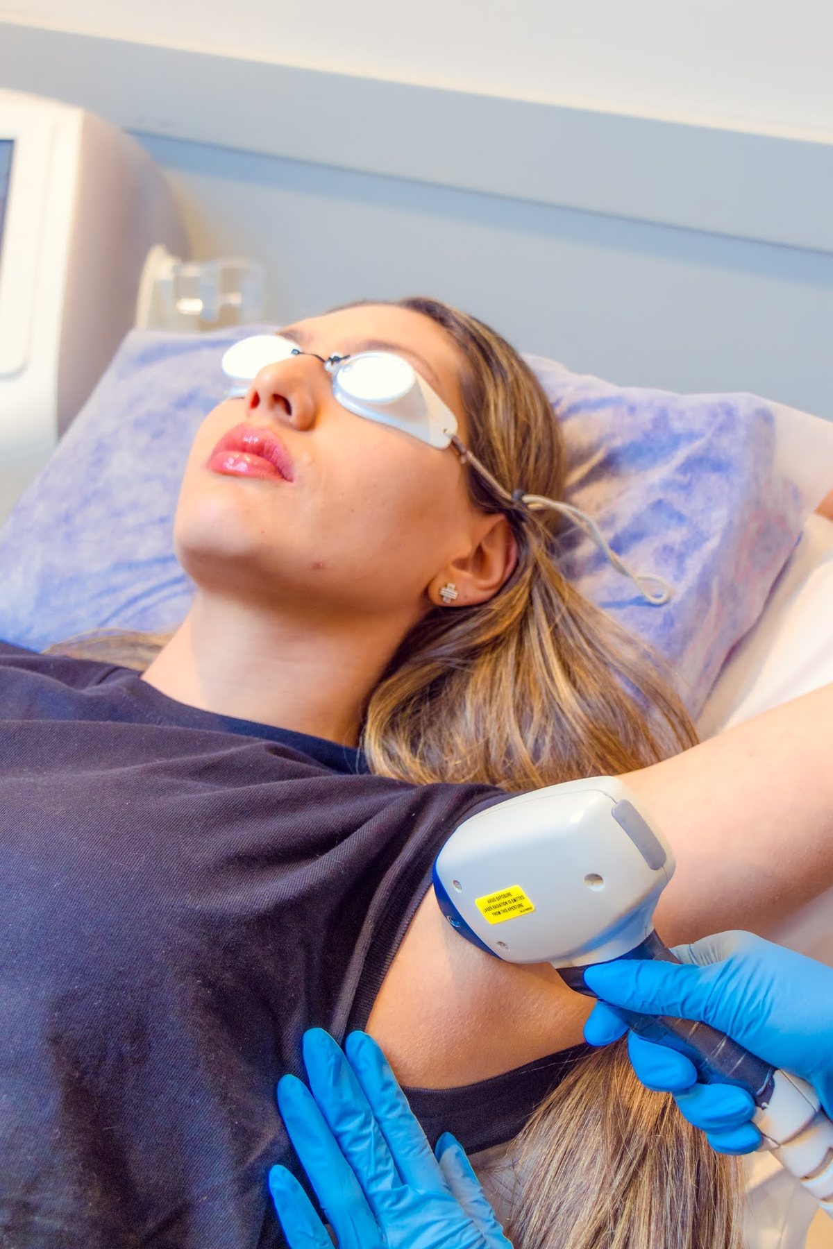 Sesión de depilación láser en Skin Plus Bogotá